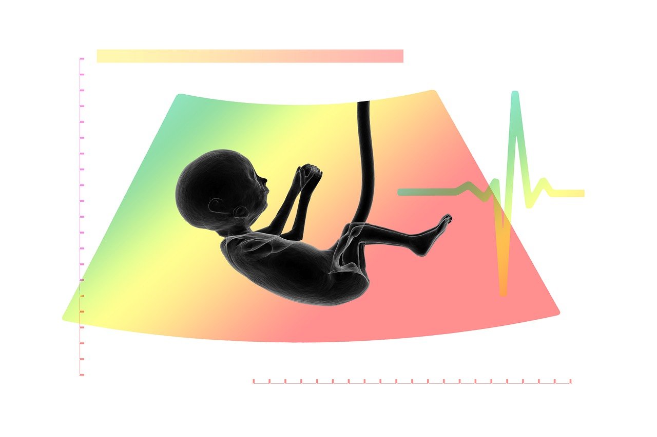 ultrasound, fetus, embryo